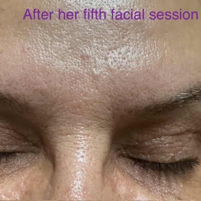 FACIAL MASSAGE